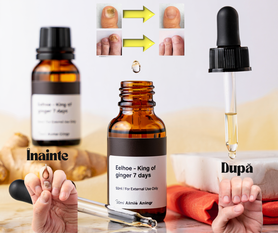Pachet profesional împotriva ciupercilor unghiilor