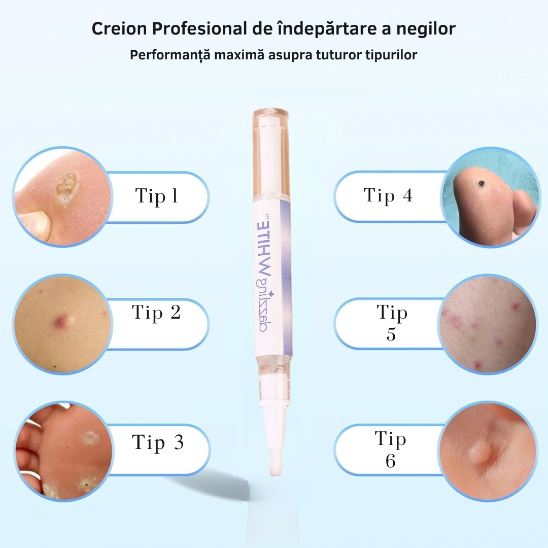 Dispozitiv profesional anti-negi