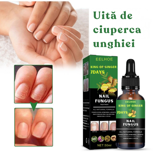 Ser împotriva ciupercilor unghiilor
